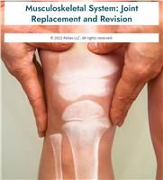 Musculoskeletal System: Joint Replacement and Revision