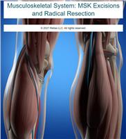 Musculoskeletal System: MSK Excisions and Radical Resection