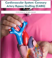 Cardiovascular System: Coronary Artery Bypass Grafting (CABG)