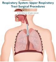 Respiratory System: Upper Respiratory Tract Surgical Procedures