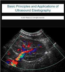 Ultrasound Elastography: Basic Principles and Applications