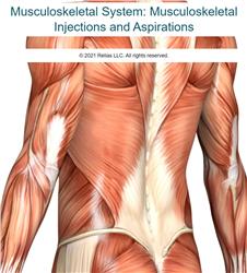 Musculoskeletal System: Musculoskeletal Injections and Aspirations