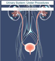 Urinary System: Ureter Procedures