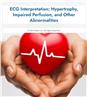 ECG Interpretation: Hypertrophy, Impaired Perfusion, and Other Abnormalities