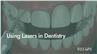 Using Lasers in Dentistry