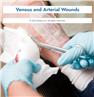 Venous and Arterial Wounds