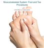 Musculoskeletal System: Foot and Toe Procedures