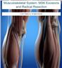 Musculoskeletal System: MSK Excisions and Radical Resection