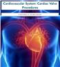 Cardiovascular System: Cardiac Valve Procedures