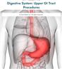 Digestive System: Upper GI Tract Procedures