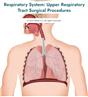 Respiratory System: Upper Respiratory Tract Surgical Procedures